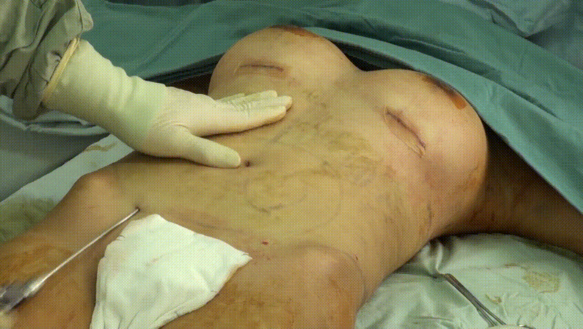 c404c3d3fb4c4b607b86487d8b9c56a9_1739520999_7371.gif