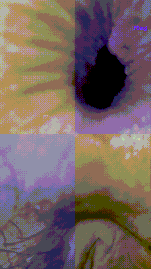 44ba9649bedf8bc2ddff943c7195c93e_1744542349_522.gif